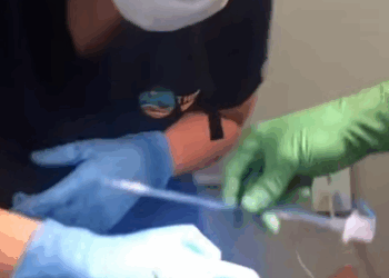 T0608031 Man rescues trapped raccoon and then animals animalsoftiktok part2