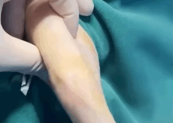 T0509076 Rescue stray dogs rescue cute helpanimals love dog part2