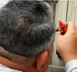 T2509034 On a rainy day I found an injured fox crossing the road and then part2