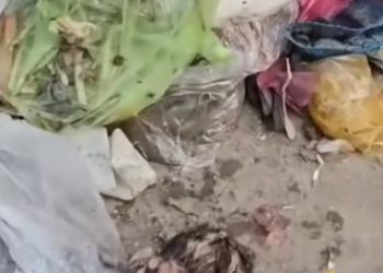 T1501010 His eyes told a story of fear, hunger, and a world that forgot him.