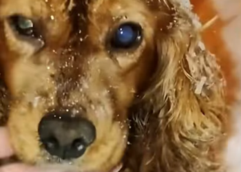 T1501014 His voice was small, but his will to live was louder than pain.