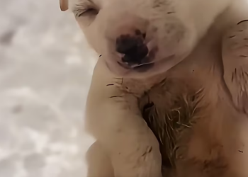 T1501024 Every small movement was a battle he didn’t choose to fight.